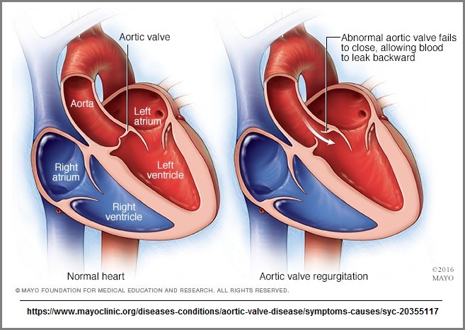 A diagram of the human heart