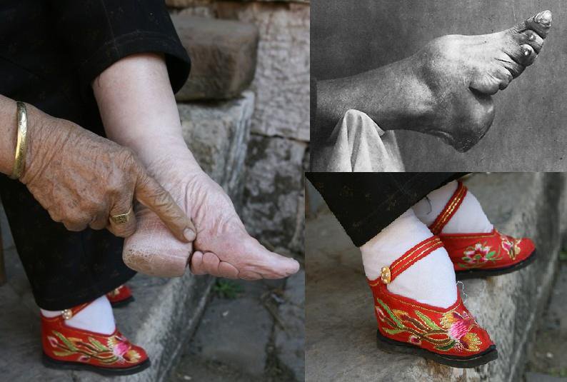 Foot Binding example (67K)