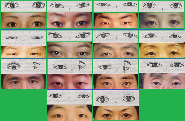 Examples of asian eye types